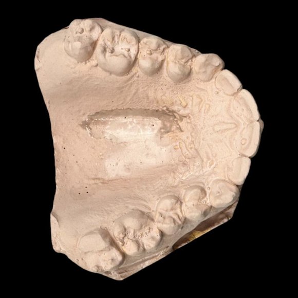 Vintage Plaster Dental Mold - Teeth Tooth Mold - Creepy Oddity - Dental Oddities - Picture 10 of 16